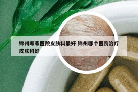 锦州哪家医院皮肤科最好 锦州哪个医院治疗皮肤科好