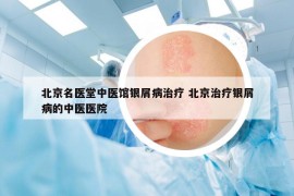 北京名医堂中医馆银屑病治疗 北京治疗银屑病的中医医院