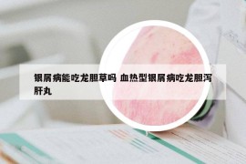 银屑病能吃龙胆草吗 血热型银屑病吃龙胆泻肝丸