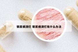 银屑病溃烂 银屑病溃烂有什么办法