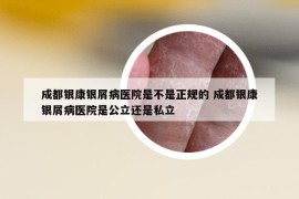 成都银康银屑病医院是不是正规的 成都银康银屑病医院是公立还是私立