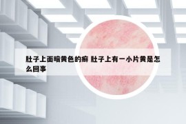 肚子上面暗黄色的癣 肚子上有一小片黄是怎么回事