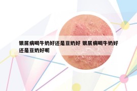 银屑病喝牛奶好还是豆奶好 银屑病喝牛奶好还是豆奶好呢