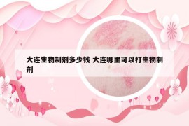 大连生物制剂多少钱 大连哪里可以打生物制剂