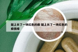 腿上长了一块红色的癣 腿上长了一块红色的癣很痒