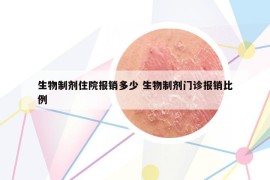 生物制剂住院报销多少 生物制剂门诊报销比例