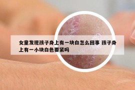 女童发现孩子身上有一块白怎么回事 孩子身上有一小块白色要紧吗