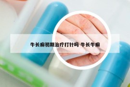 牛长癣初期治疗打针吗 牛长牛癣