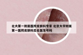 北大第一附属医院皮肤科专家 北京大学附属第一医院皮肤科出名医生号码