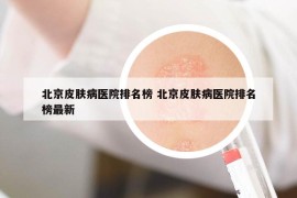 北京皮肤病医院排名榜 北京皮肤病医院排名榜最新