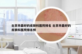 北京市最好的皮肤科医院排名 北京市最好的皮肤科医院排名榜