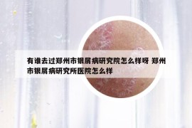 有谁去过郑州市银屑病研究院怎么样呀 郑州市银屑病研究所医院怎么样