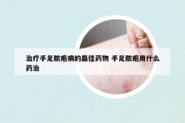 治疗手足脓疱病的最佳药物 手足脓疱用什么药治