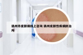 扬州市皮肤病线上咨询 扬州皮肤性疾病防治所