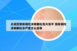 点滴型银屑病吃消银颗粒变大变平 银屑病吃消银颗粒会严重怎么回事