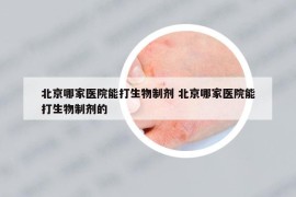 北京哪家医院能打生物制剂 北京哪家医院能打生物制剂的