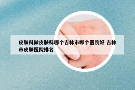 皮肤科做皮肤科哪个吉林市哪个医院好 吉林市皮肤医院排名