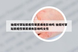 抽烟对掌趾脓疱性银屑病有影响吗 抽烟对掌趾脓疱性银屑病有影响吗女性