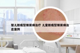 婴儿脓疱型银屑病治疗 儿童脓疱型银屑病治愈案例