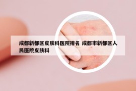 成都新都区皮肤科医院排名 成都市新都区人民医院皮肤科