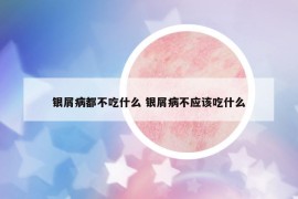 银屑病都不吃什么 银屑病不应该吃什么