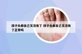 孩子头癣自己又没有了 孩子头癣自己又没有了正常吗