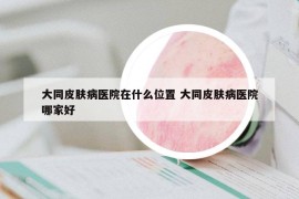 大同皮肤病医院在什么位置 大同皮肤病医院哪家好