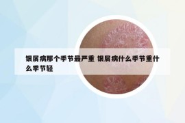 银屑病那个季节最严重 银屑病什么季节重什么季节轻