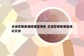 点滴型银屑病疙瘩变褐色 点滴型银屑病变成红片状