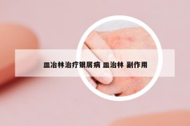 皿冶林治疗银屑病 皿治林 副作用