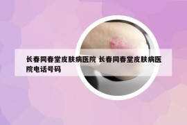 长春同春堂皮肤病医院 长春同春堂皮肤病医院电话号码