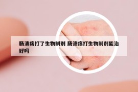 肠溃疡打了生物制剂 肠溃疡打生物制剂能治好吗