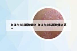 九江市皮肤医院排名 九江市皮肤医院排名第一