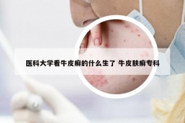 医科大学看牛皮癣的什么生了 牛皮肤癣专科