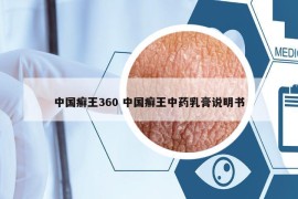 中国癣王360 中国癣王中药乳膏说明书