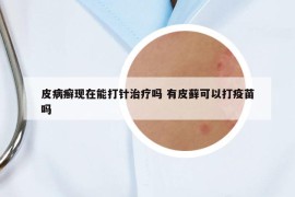 皮病癣现在能打针治疗吗 有皮藓可以打疫苗吗