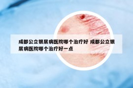 成都公立银屑病医院哪个治疗好 成都公立银屑病医院哪个治疗好一点