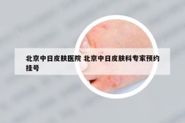 北京中日皮肤医院 北京中日皮肤科专家预约挂号