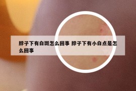 脖子下有白斑怎么回事 脖子下有小白点是怎么回事