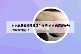 小小志愿者清理社区牛皮癣 小小志愿者参与社区疫情防控