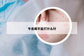 牛皮癣不能打什么针