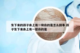 生下来的孩子身上有一块白的是怎么回事 孩子生下来身上有一层白的是