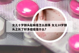 女儿十岁额头起癣是怎么回事 女儿10岁额头上长了好多痘痘是什么?