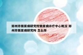 郑州市银屑病研究院银屑病诊疗中心概况 郑州市银屑病研究所 怎么样