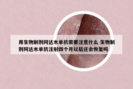 用生物制剂阿达木单抗需要注意什么 生物制剂阿达木单抗注射四个月以后还会恢复吗