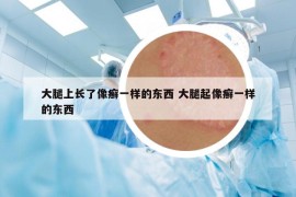 大腿上长了像癣一样的东西 大腿起像癣一样的东西