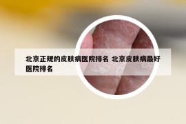 北京正规的皮肤病医院排名 北京皮肤病最好医院排名