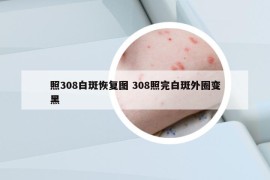 照308白斑恢复图 308照完白斑外圈变黑