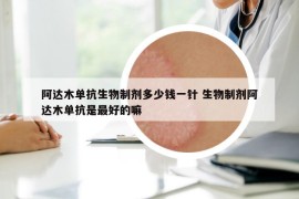 阿达木单抗生物制剂多少钱一针 生物制剂阿达木单抗是最好的嘛