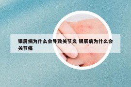 银屑病为什么会导致关节炎 银屑病为什么会关节痛